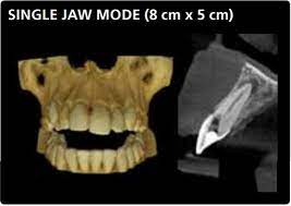 single view jaw mode